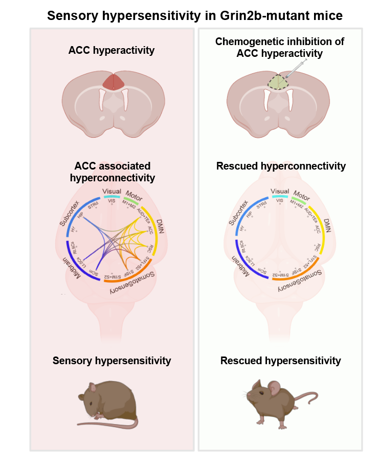 Brain Mechanisms Underlying Sensory Hypersensitivity in a Mouse Model of Autism Spectrum Disorder 이미지