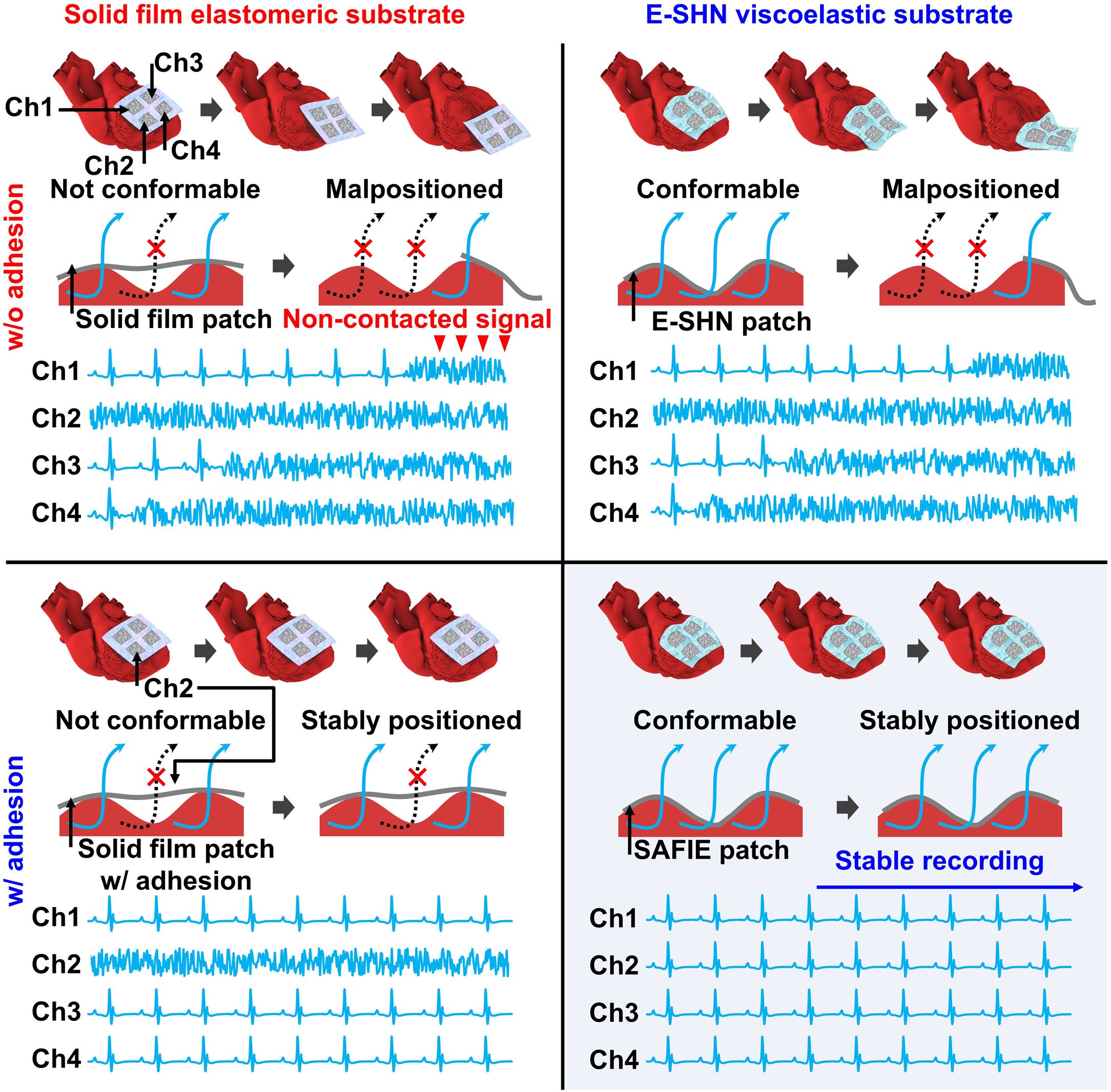 Adhesive bioelectronics for sutureless cardiac interfacing 이미지
