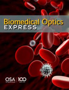 Optical lens-microneedle array for percutaneous light delivery image