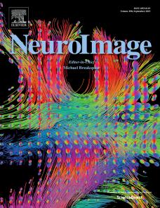 Dominance of layer-specific microvessel dilation in contrast-enhanced high-resolution fMRI: Comparison between hemodynamic spread and vascular architecture with CLARITY image