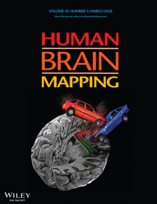 human brain mapping impact factor human brain mapping impact factor