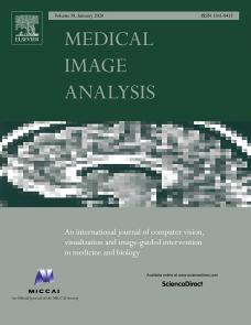 Model-Based High-Deﬁnition Dynamic Contrast Enhanced MRI for Concurrent Estimation of Perfusion and Microvascular Permeability image
