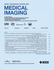 Joint-connectivity-based sparse canonical correlation analysis of imaging genetics for detecting biomarkers of Parkinson’s disease image