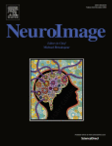 Toward a connectivity gradient-based framework for reproducible biomarker discovery image