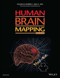 Induced astigmatism biases the orientation information represented in multivariate electroencephalogram activities image
