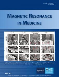 Role of chemical exchange on the relayed nuclear Overhauser enhancement signal in saturation transfer MRI image