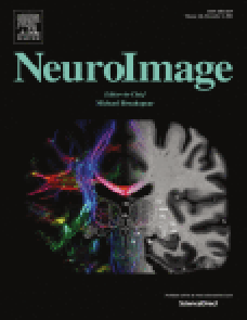 Neural representations of ensemble coding in the occipital and parietal cortices image