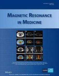 Rapid calculation of static magnetic field perturbation generated by magnetized objects in arbitrary orientations image