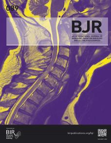 Overview of radiomics in prostate imaging and future directions image