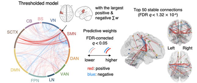 Affective Neuroscience Team > Brain Science Group > Research > Ibs